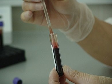 Immune discovery 'may treat all cancer'
